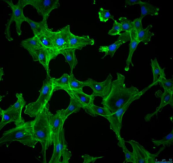 DOV13 Human Ovarian Carcinoma Cell Line | SCC186